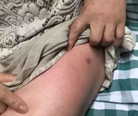 被咬女孩脑死亡!这就是真相!医生曝光事件经过及原因详情真相让人不寒而栗....(